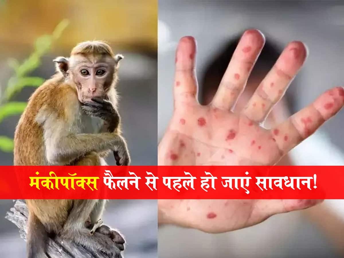 12 देशों में फैल चुका है Monkeypox virus! भारत में आए उससे पहले जान लें ये सभी जरूरी बातें, रहेंगे सेफ